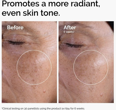 Toning Solution The Ordinary Glycolic Acid 7%