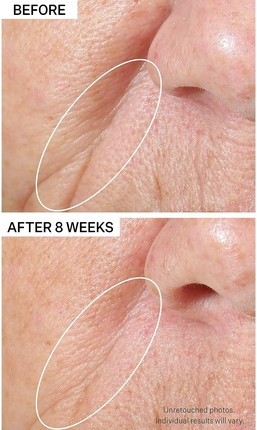 Serum Strivectin Peptight Tightening and Brightening Face Serum
