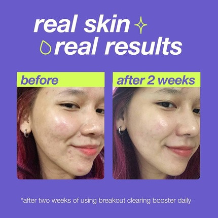 Akne-Behandlung Dermalogica Clear Start Breakout Clearing Booster