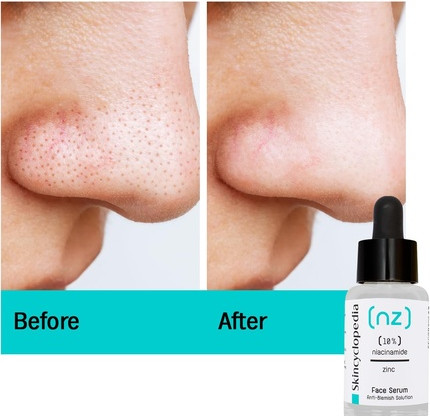 Serum Skincyclopedia