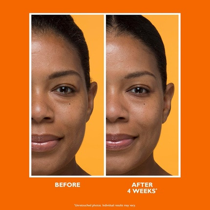 Peter Thomas Roth Potent-C Yuzilgan Vitamin S Biologik Faol Namlagich Kremi