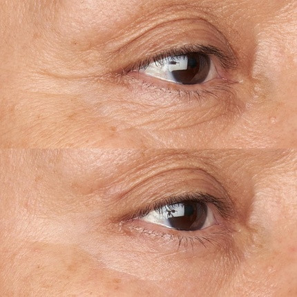 Eye Cream Perricone Md Hypoallergenic Clean Correction Firming & Brightening