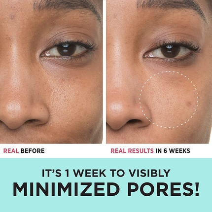 Serum It Cosmetics Bye Bye Pores