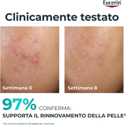 Facial Exfoliating Treatment Eucerin Dermopure Clinical