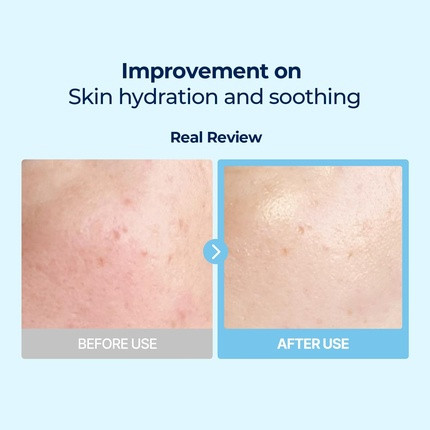 Toner Pads Torriden DIVE-in Vegan Hyaluronic Acid