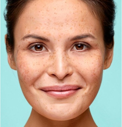 Serum Biodermal Anti Age Gesichts-Serum
