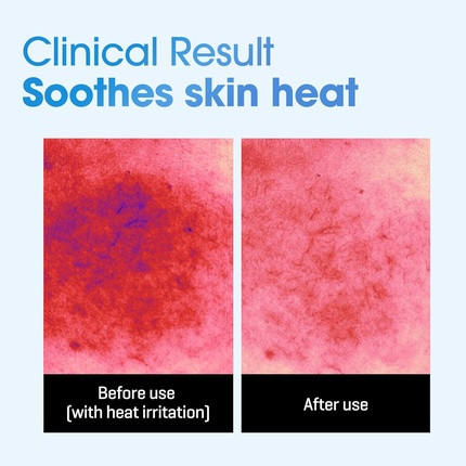 Sheet Mask Some By Mi Beta-Panthenol Repair Daily Mask