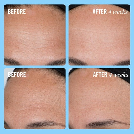 Cream First Aid Beauty Firming Collagen Cream with Collagen, Peptides, and Niacinamide