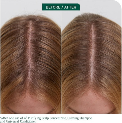 Scalp Concentrate Biolage Scalp Sync Reinigendes Konzentrat für ausgeglichene Kopfhautfeuchtigkeit