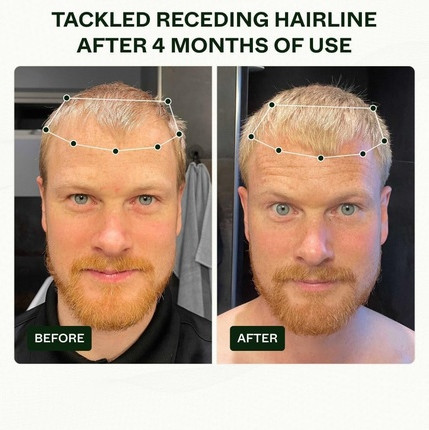 Haarwasser Scandinavian Biolabs Bio-Pilixin Routine für Männer