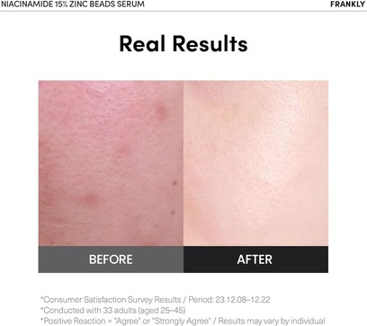 Serum Frankly Niacinamide 15% & Zinc Beads