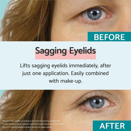 Cream Remescar Sagging Eyelids Instant Treatment