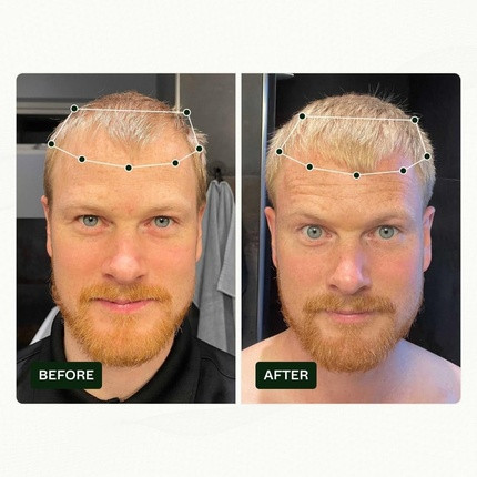 Hair Serum Scandinavian Biolabs Bio-Pilixin