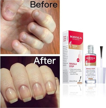 Treatment Mavala Stop Nail Biting and Thumb Sucking Treatment