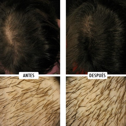 Hair Tonic The Cosmetic Republic