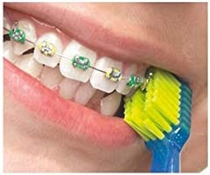 Ортодонтический набор Curaprox Ortho Box