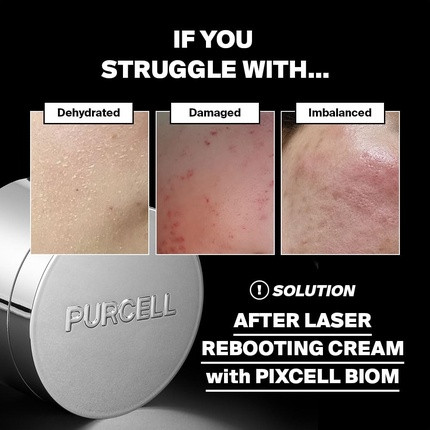 Gesichtscreme Purcell Pixcell Biom After Laser Rebooting Cream für die Wiederherstellung der probiotischen Barriere