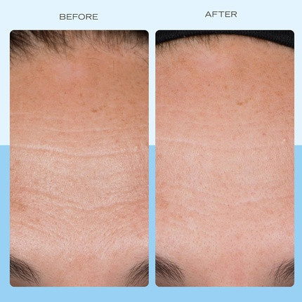 Face Cream First Aid Beauty Firming Collagen Cream with Peptides and Niacinamide