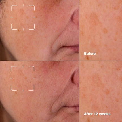 Serum Clinique Even Better Clinical Dark Spot Clearing Serum with Vitamin C