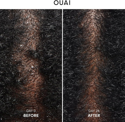 Shampoo Ouai Anti-Schuppen Beruhigend mit Salicylsäure