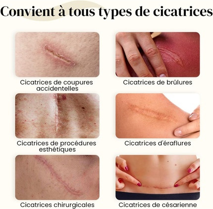 Гель Dermatix Acne