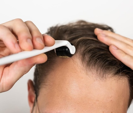 Derma Roller Scandinavian Biolabs mit 540 Titan-Nadeln