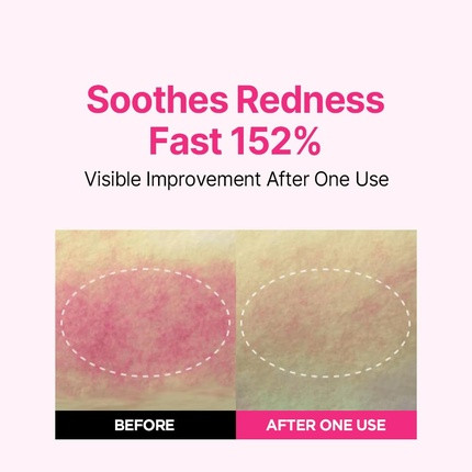 Hydratisierendes Serum Isoi Blemish Care Up Serum