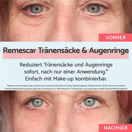 Eye Cream Remescar Eye Bags & Dark Circles
