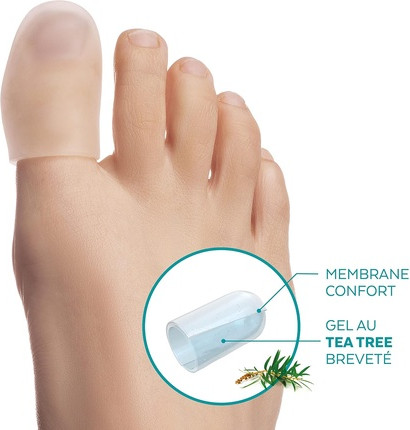 Protective and Repairing Toe Cap Tea Gel Poderm