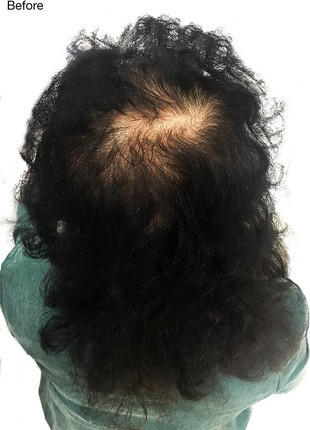 Haarverdichtungsfasern Nanogen Haarverdichtungsfasern