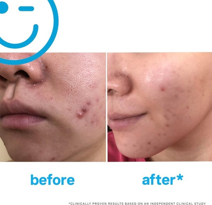 Cleanser Kate Somerville Eradikate