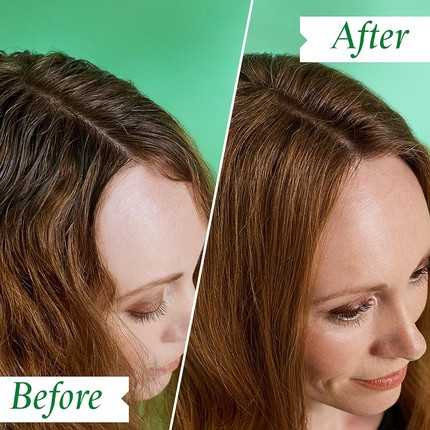 Philip Kingsley Flaky Scalp Shampoo