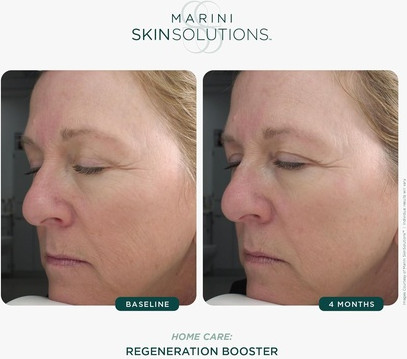 Regeneration Booster Jan Marini