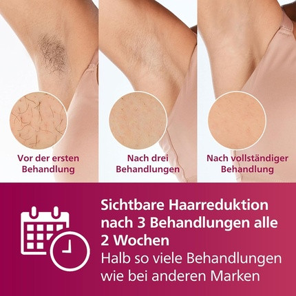 IPL Haarentfernungsgerät Philips Serie 7000