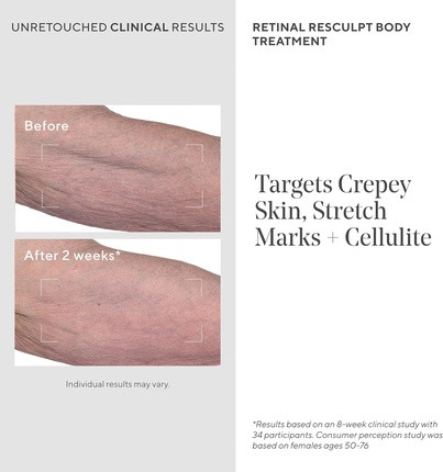 Body Cream Murad Retinal Resculpt Body Treatment