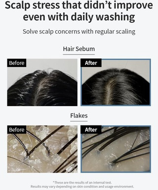 Scalp Scaler Grow Gorgeous